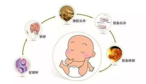 苏州三代试管费用解析，了解一下需要花费多少钱？（附成功率和费用）